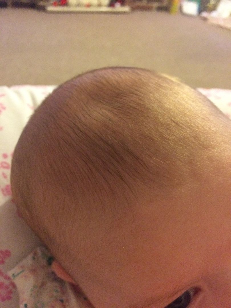 Pictures of sunken soft spot on baby - disney world images to print