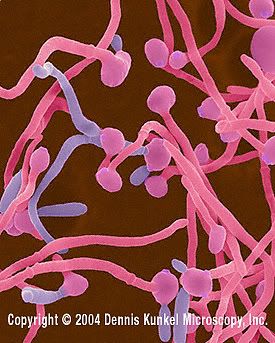 candida-alb-dk3.jpg