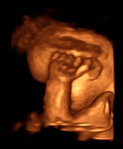 handbyheadfist.jpg